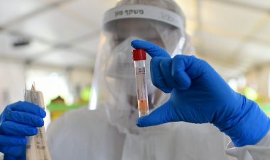 Coronavirus Pandemic: Ξεκινούν τα τεστ κατ’ οίκον με 500 Κινητές Μονάδες Υγείας [Αναλυτικά η KYA]