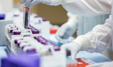 Coronavirus Pandemic: Ελαφρώς θετικά αλλά και αβέβαια τα πρώτα αποτελέσματα στις ΗΠΑ από τη χορήγηση πλάσματος αναρρωσάντων σε ασθενείς με Covid-19