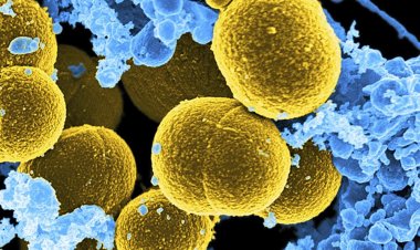 Coronavirus Disease: 2.311 νέα περιστατικά μόλυνσης –  522 νοσηλεύονται διασωληνωμένοι, 108 νέοι θάνατοι