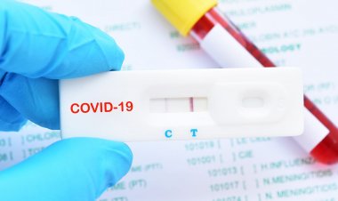 COVID-19 Antigen Self-Test: 11+1 ερωτήσεις και απαντήσεις για τα self test – Όλα όσα πρέπει να γνωρίζετε