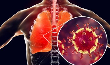 Coronavirus Disease: 1.606 νέα περιστατικά μόλυνσης  –  781 νοσηλεύονται διασωληνωμένοι, 76 νέοι θάνατοι