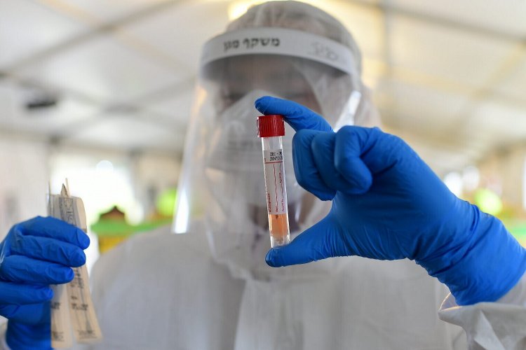 Coronavirus Pandemic: Ξεκινούν τα τεστ κατ’ οίκον με 500 Κινητές Μονάδες Υγείας [Αναλυτικά η KYA]