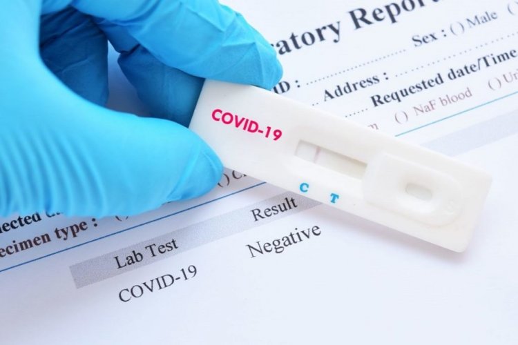 Coronavirus Travel: Τα rapid test σανίδα σωτηρίας για τον Τουρισμό!! Τι έδειξε η μελέτη στο Αττικόν για τα "γρήγορα τεστ ανίχνευσης κορωνοϊού"