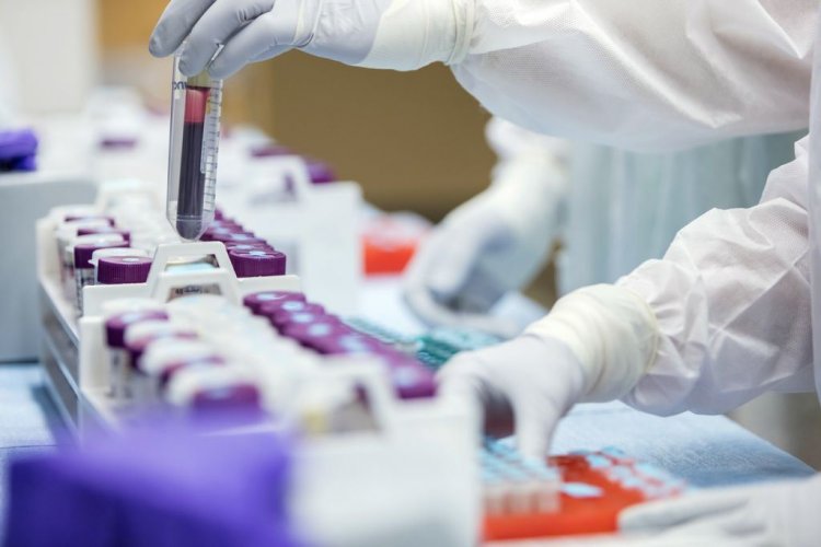 Coronavirus Pandemic: Ολλανδοί ερευνητές ανακάλυψαν αντίσωμα που «μπλοκάρει» τον κορονοϊό