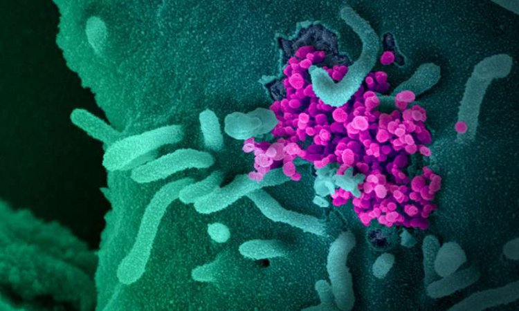 Coronavirus Disease: 399 νέα περιστατικά μόλυνσης – 87 νοσηλεύονται διασωληνωμένοι, 3 νέοι θάνατοι