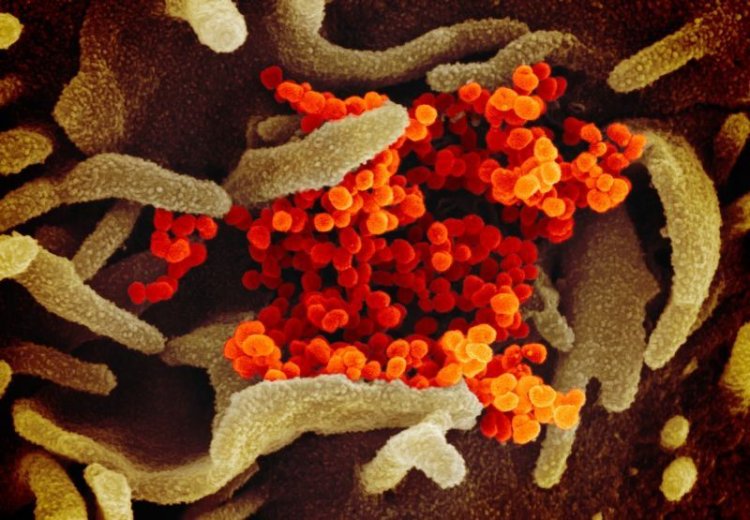 Coronavirus Disease: 1.690 νέα περιστατικά μόλυνσης –  128 νοσηλεύονται διασωληνωμένοι, 5 νέοι θάνατοι