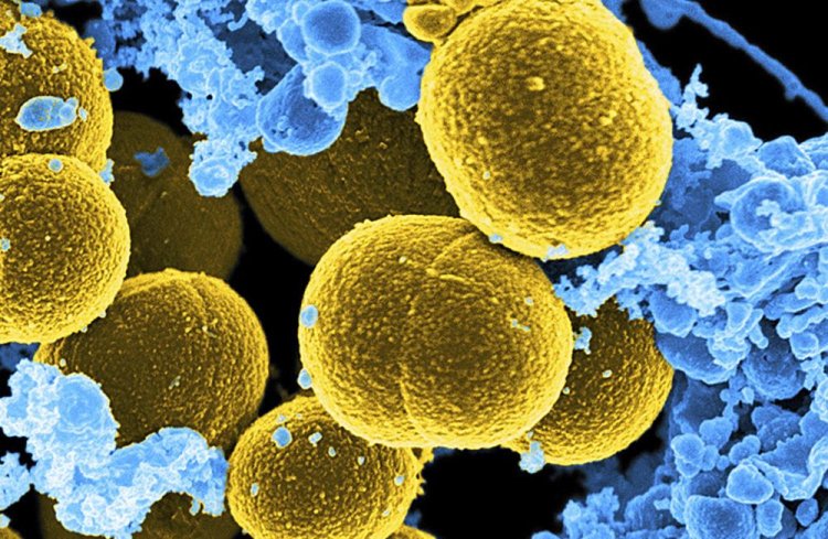 Coronavirus Disease: 2.152 νέα περιστατικά μόλυνσης –  597 νοσηλεύονται διασωληνωμένοι, 87 νέοι θάνατοι