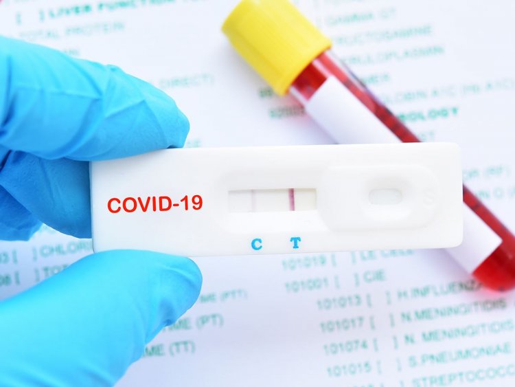 COVID-19 Antigen Self-Test: 11+1 ερωτήσεις και απαντήσεις για τα self test – Όλα όσα πρέπει να γνωρίζετε