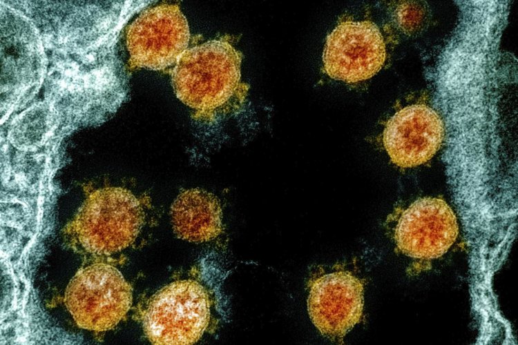 Coronavirus Disease: 16 κρούσματα στο Νότιο Αιγαίο  -  252  κρούσματα σε Αττική, 38 σε Θεσσαλονίκη - Η κατανομή