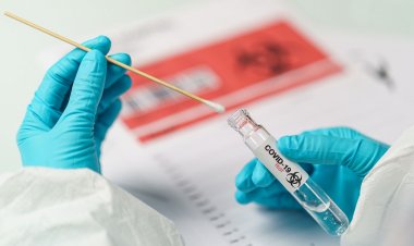 Covid-19 self-testing: Τέλος στον υποχρεωτικό Self testing έλεγχο από 1η Ιουλίου για τους εμβολιασμένους!! Σε ποιους επαγγελματικούς κλάδους συνεχίζονται!!